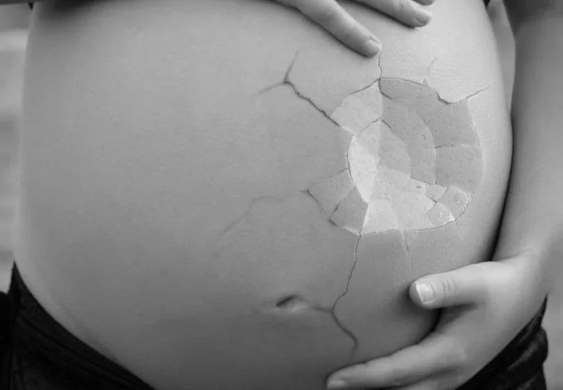  L’America si rimangia le sue conquiste: l’aborto si scontra con la Corte Suprema